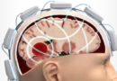 „Mikrofalowy kask” może skrócić czas potrzebny do oceny urazów głowy