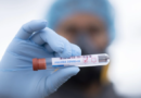 Naukowcy opracowali dokładny i wszechstronny test na koronawirusa