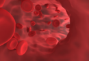 Odkryto produkty zwiększające poziom hemoglobiny