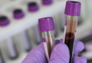 W ludzkiej krwi po raz pierwszy odkryto mikroplastik