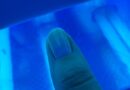 Lampy UV do paznokci mogą powodować uszkodzenie DNA?