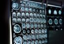 Bezpieczne i skuteczne przygotowanie do tomografii komputerowej: Wskazówki i instrukcje